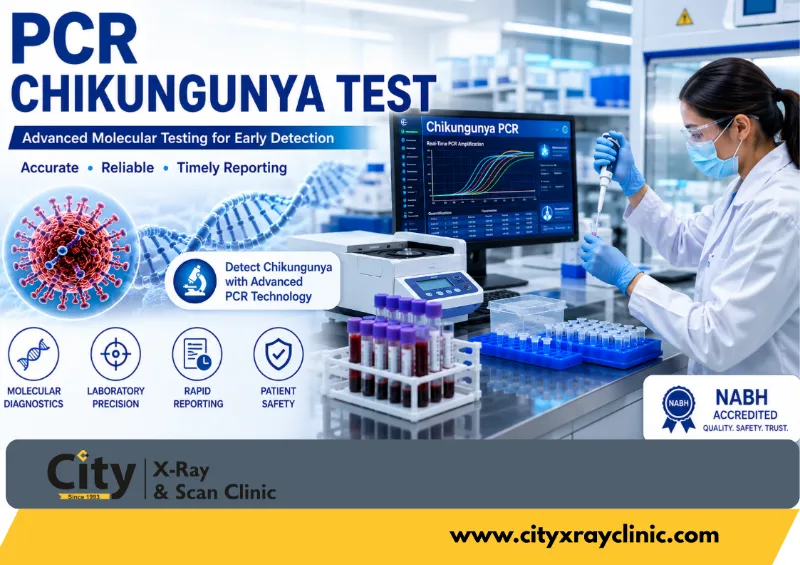 PCR Chikungunya Test – Book Now - Medical And Health care for sale in West Delhi, Delhi